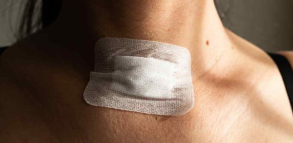 Why is diet so important after thyroidectomy